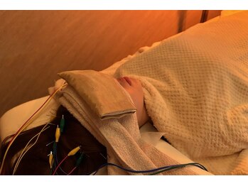 デルタエヌピー63+(δnp63+)/お客様施術例【小顔/薬院/福岡】