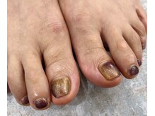 サロンドルア 亀有(Salon de Lua)/フットアートネイル