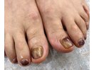 フットアートネイル