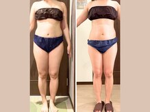 リライブ 亀有店(Re:Lives)/全身ビフォーアフター【痩身】