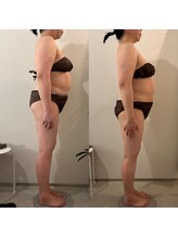 ラナ 京都西院店(Lana)/よもぎ蒸し＆リンパマッサージ