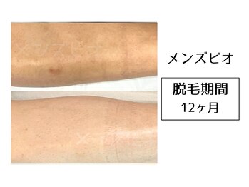 メンズビオ 神戸三宮店/