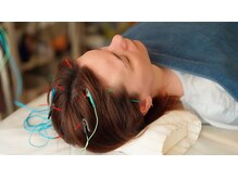 頭皮鍼は育毛促進や脳疲労に抜群です