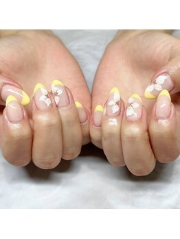 イエローフレンチ