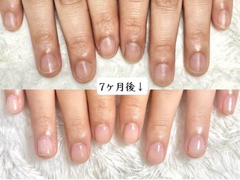 グレースレディ/(深爪/長さだし/フィルイン)