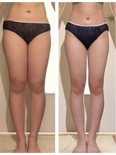 パルティール 恵比寿店(partir)/下半身太りもさようなら～