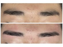 ベリル 金町店(Beryl)/