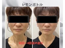 フルーア(FULUA)/レモンボトル