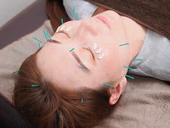 トラスト整骨院鍼灸院の写真/【家事/育児で凝り固まった首肩こりを撃退!】姿勢改善のプロが再発しない身体作りから予防までを徹底指導♪