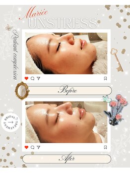 ハレル(Hareru)/Before…After(6)　UNSTRESS