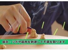 つつじが丘整骨院鍼灸マッサージ院/鍼灸施術