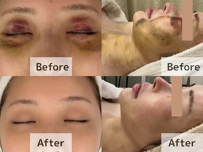 ナナ 銀座(Nana)の写真