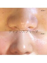 ディア スプリーマ/タラソトリートメントで美肌☆