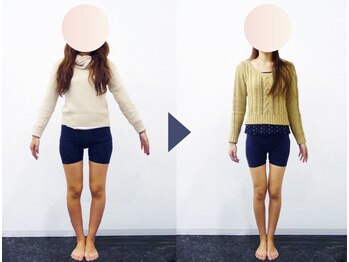 美デザイン 小倉店(美.design)/☆美脚O脚+美尻骨盤矯正