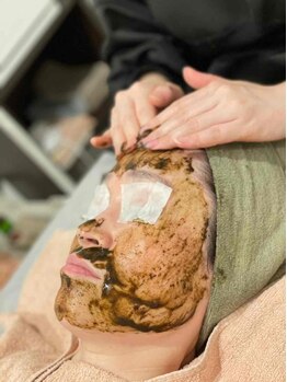 リズ(Liz)の写真/シミ,ニキビ,しわに働きかける！敏感肌の方にも優しいピーリング☆お肌のお悩みを根元から改善します◎