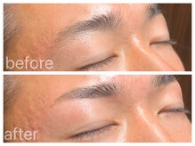 クラシックス(CLASSICS)/before&after