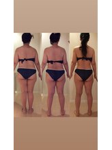 ホロニック ベルサンテ(Holonic Belle Sante)/メディセルハイブリッド