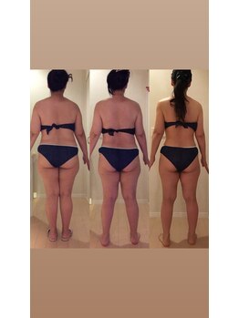 ホロニック ベルサンテ(Holonic Belle Sante)/メディセルハイブリッド