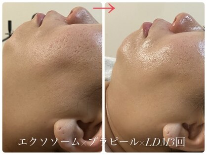 グラン ジュテの写真