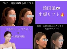 ナースセレクトサロン(Nurse select salon)の雰囲気（デザインリフトアップ！理想の輪郭造れます＃エリクサリフト）