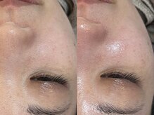 ビーマジック(Be Magic)/NEWクーポン！