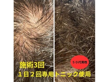 エヌクリア(N CLEAR)の写真