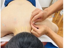 健盛鍼灸接骨院の雰囲気（【頭痛/肩こり/耳鳴り】鍼灸でさまざまなお悩み解決！）