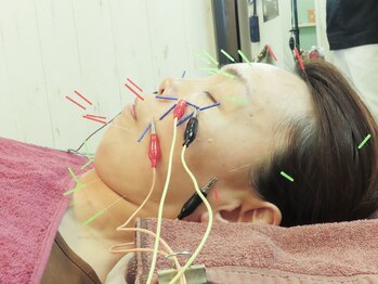 所沢鍼灸整体院/お顔のシワ改善は首のケアが先