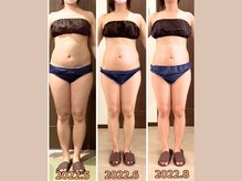 リライブ 亀有店(Re:Lives)/全身ビフォーアフター【痩身】