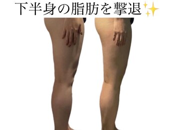 痩身革命 大宮店/ダイエットリンパマッサージ