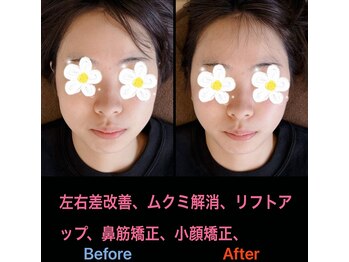 美容矯正サロン レレポノ(LELEPONO)/