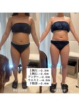 千歳の女神 久屋大通店/【施術風景】Berore/After