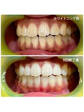 ワイズサロン(Y's salon)/月1のメンテナンスで☆