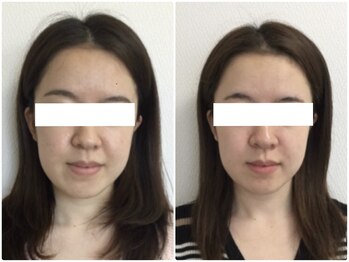 美容整体ウェリナ あま甚目寺院/小顔矯正/骨盤矯正/美脚サロン