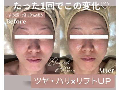 ブーケ(Bouquet)の写真