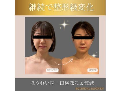 エン 橿原店(en)の写真