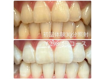 ホワイトニングルーム 横浜店(Whitening Room)/セルフホワイトニング/横浜