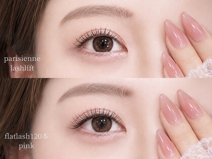 エトルカ(etorca)の写真