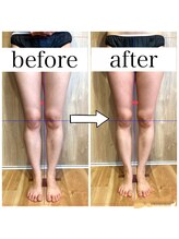 ナチュール(Nature)/脚のむくみビフォーアフター