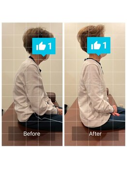 るい鍼灸整骨院/姿勢矯正年齢は関係ありません！