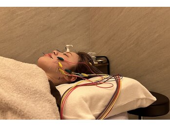 デルタエヌピー63+(δnp63+)/お客様施術例【小顔/薬院/福岡】