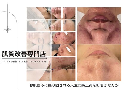 美時雨の写真