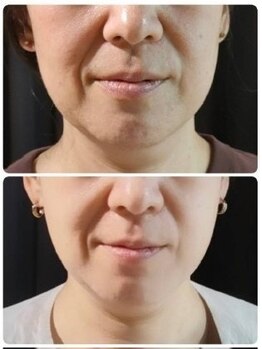 ファームディ(Pharm.D)/たるみで悩んでいる方へ