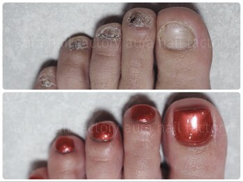 アウラ ネイル ファクトリー(aura nail factory)/FOOT深爪矯正スカルプ［赤羽駅］