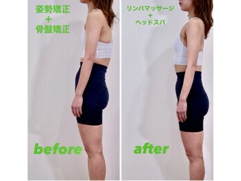 アズール(azure)の写真/骨盤矯正×姿勢改善で身体バランスを整える整体。肩こり・腰痛の根本ケアに。スタイル改善や美容整体も◎