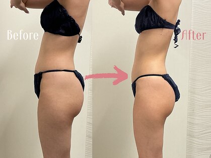 エスビーエス オキナワ(SBS OKINAWA)の写真