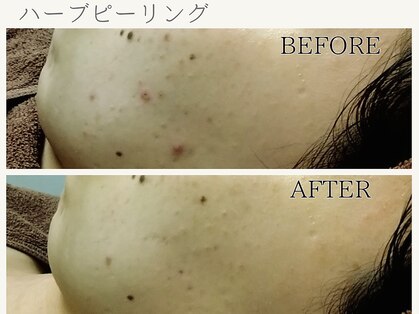 サロン ピューパ(Salon pupa)の写真