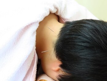 はじめ鍼灸整骨院/鍼灸施術