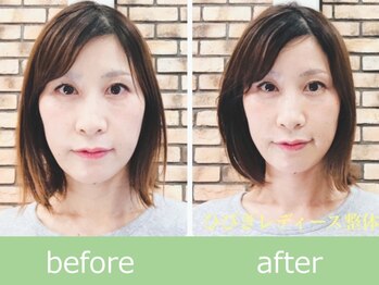 ひびきレディース整体 日吉/結婚式前に自分史上最高の小顔へ