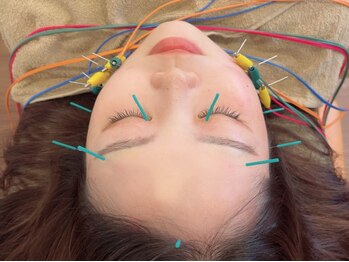 ヒーリングサロン アージュ(A-je)の写真/お顔のたるみ改善・ハリツヤUPには電気美容鍼◎鍼灸師歴12年の院長が悩みに合せた施術でアプローチします★
